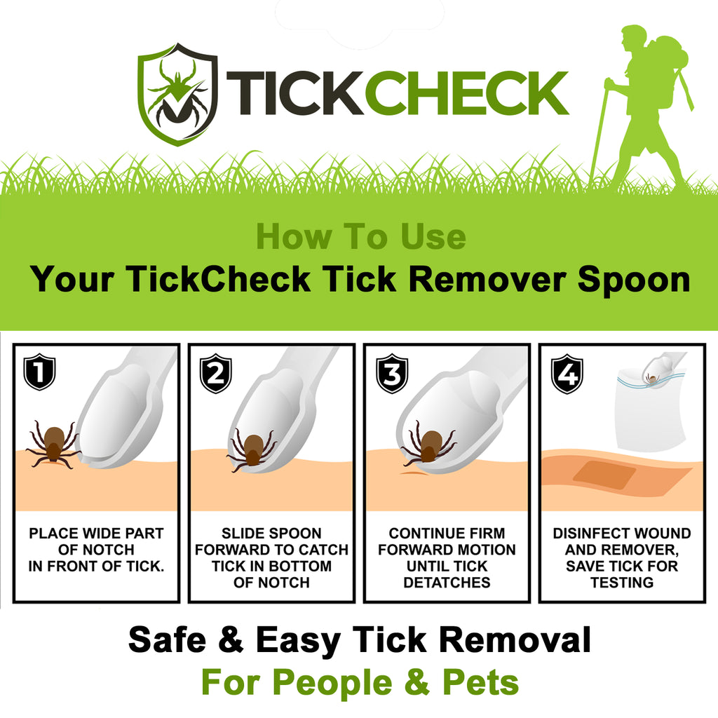 TickCheck Tick Remover Spoons – 3-Pack